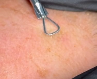 govichi-higiene-facial-extraccion